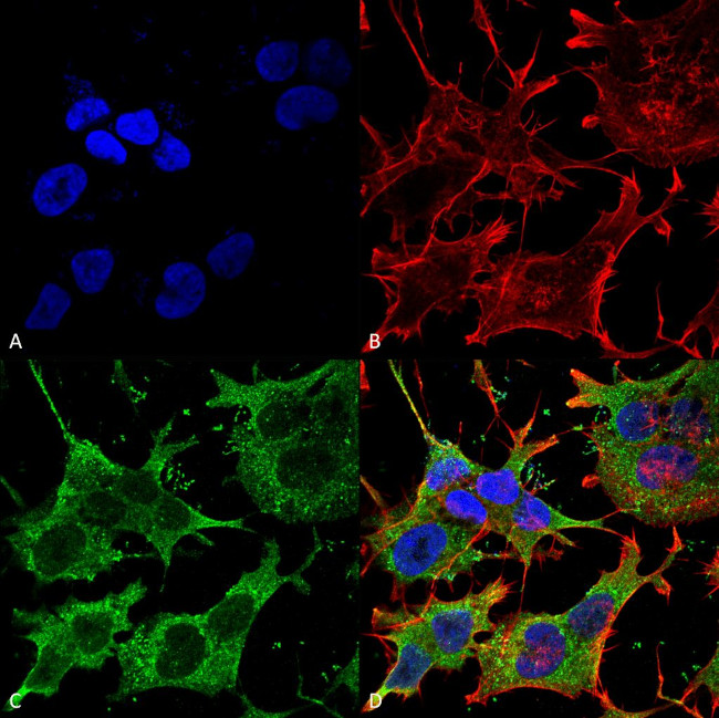 SLC38A1 Antibody in Immunocytochemistry (ICC/IF)