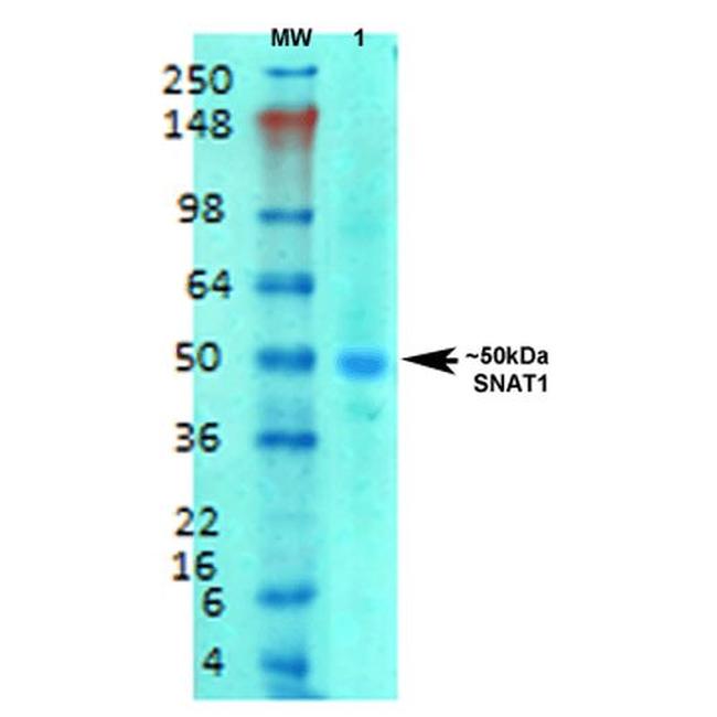 SLC38A1 Antibody in Western Blot (WB)