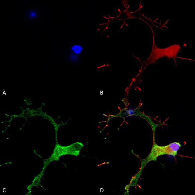 GABBR1 Antibody in Immunocytochemistry (ICC/IF)