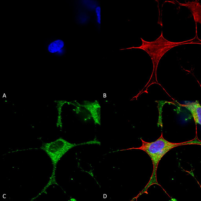 CLCN3 Antibody in Immunocytochemistry (ICC/IF)