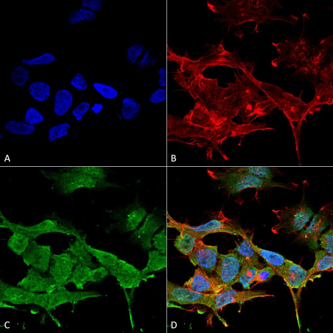 CLCN3 Antibody in Immunocytochemistry (ICC/IF)