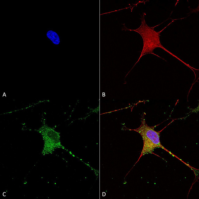 SUR1 Antibody in Immunocytochemistry (ICC/IF)