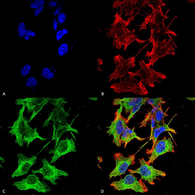 NMDAR1 Antibody in Immunocytochemistry (ICC/IF)