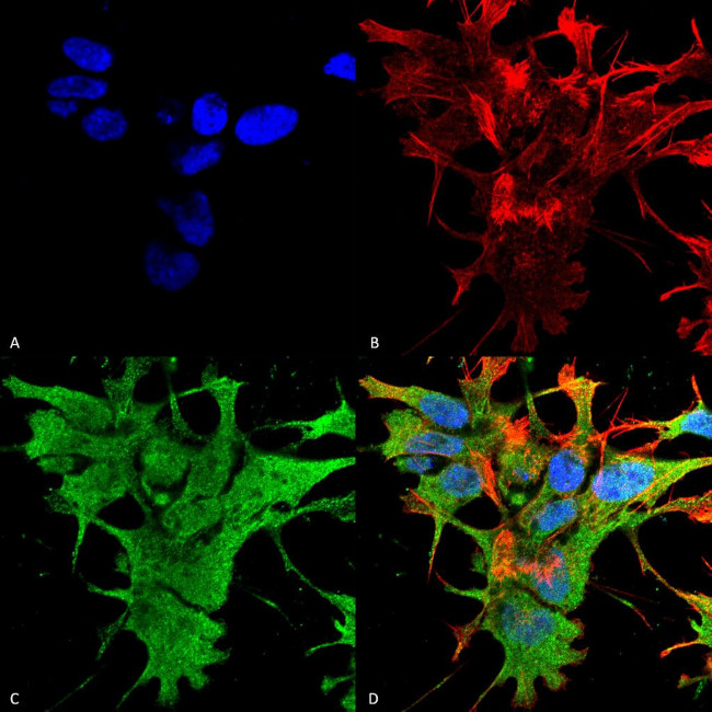 Dicer Antibody in Immunocytochemistry (ICC/IF)