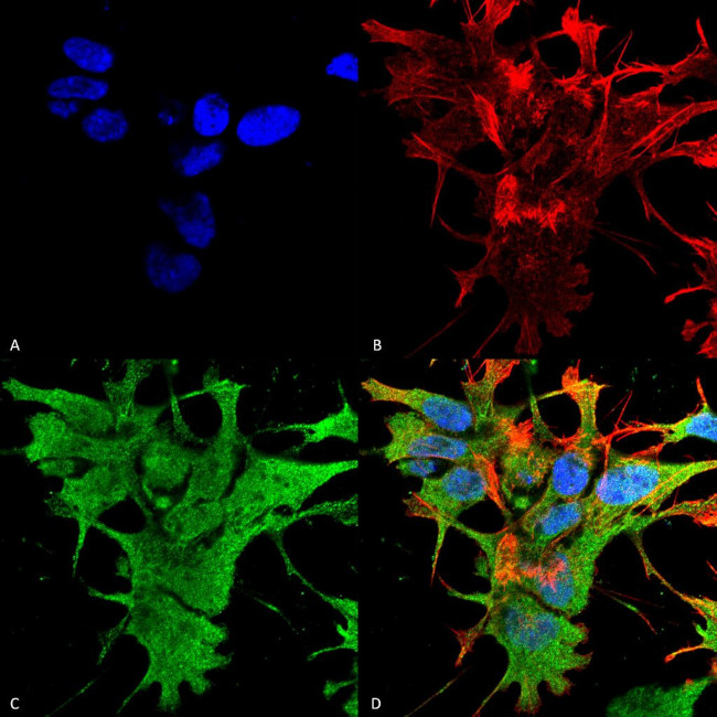 Dicer Antibody in Immunocytochemistry (ICC/IF)