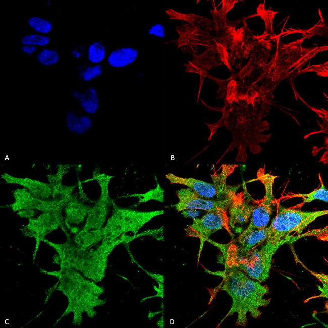 Dicer Antibody in Immunocytochemistry (ICC/IF)