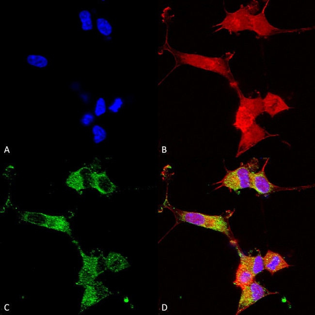 NALCN Antibody in Immunocytochemistry (ICC/IF)