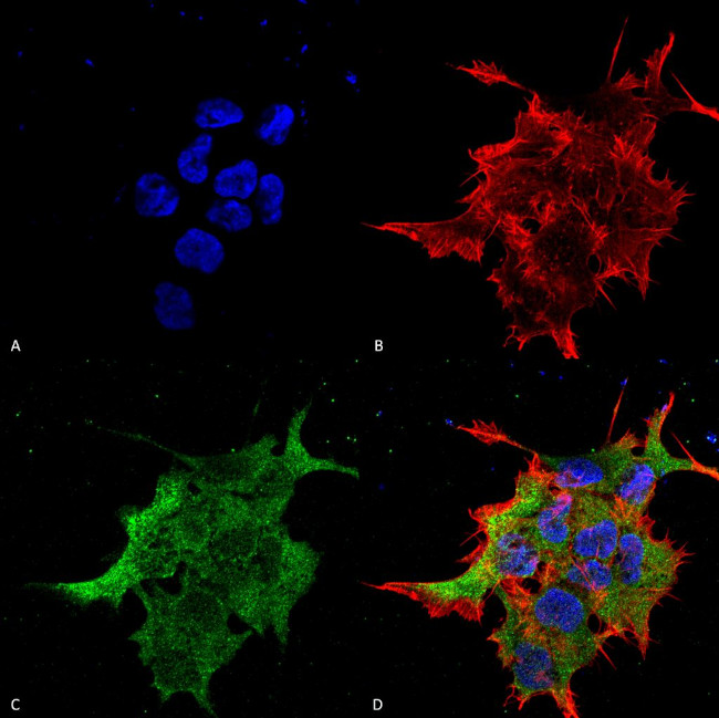 NALCN Antibody in Immunocytochemistry (ICC/IF)