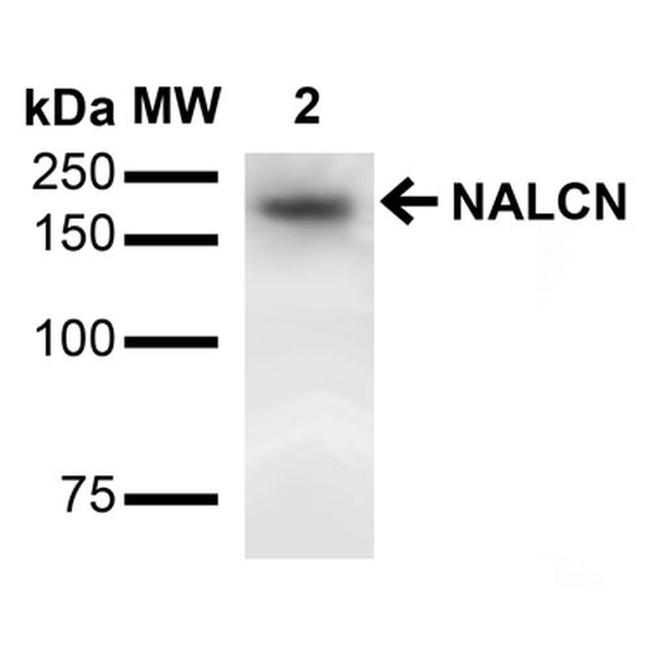 NALCN Antibody in Western Blot (WB)
