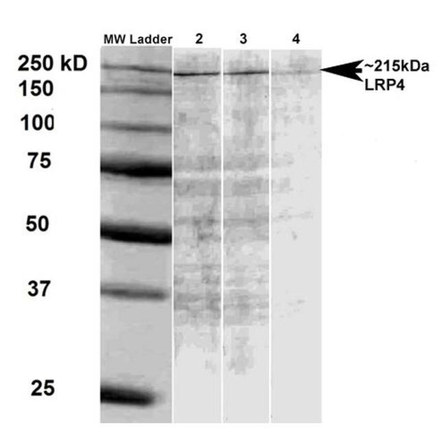 LRP4 Antibody in Western Blot (WB)