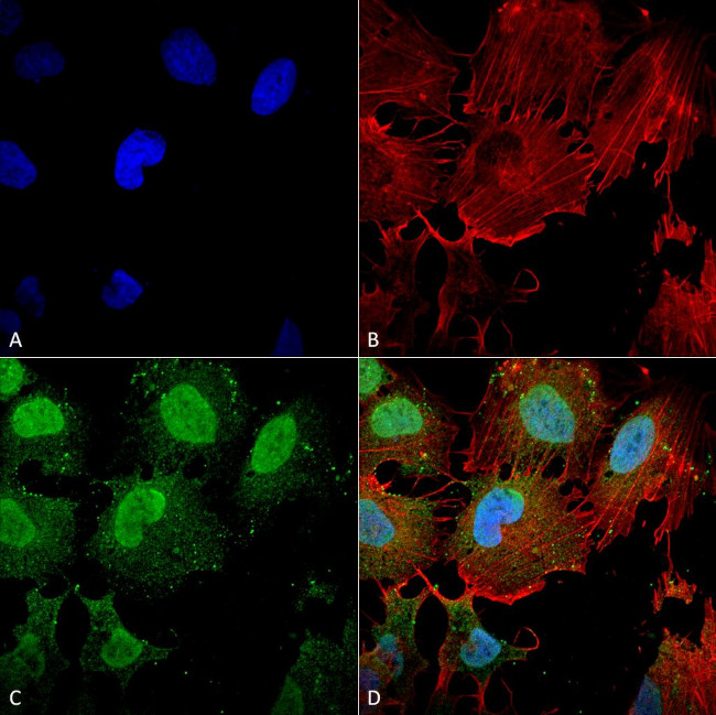 mGluR1/mGluR5 Antibody in Immunocytochemistry (ICC/IF)