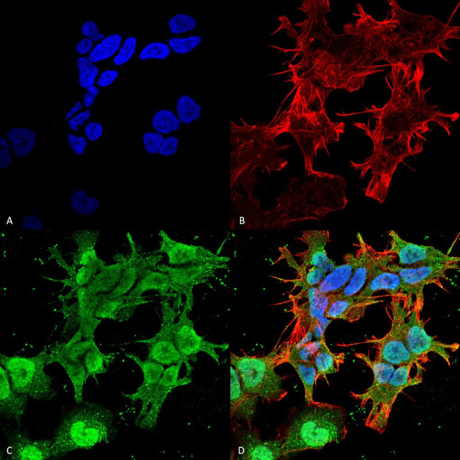 CACNG2/4/8 Antibody in Immunocytochemistry (ICC/IF)