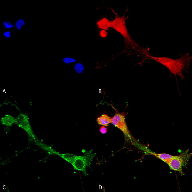 ASIC1 Antibody in Immunocytochemistry (ICC/IF)