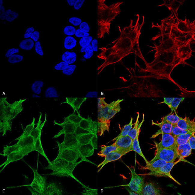 NMDAR2A Antibody in Immunocytochemistry (ICC/IF)