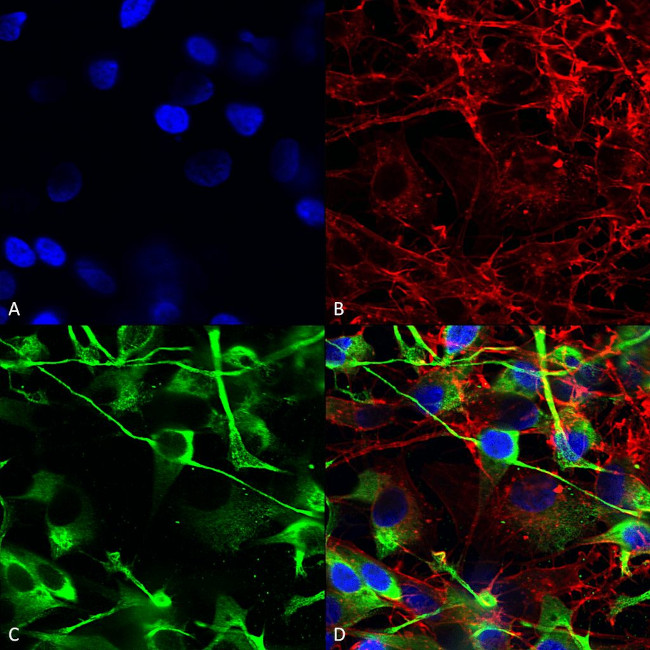 NMDAR2A Antibody in Immunocytochemistry (ICC/IF)