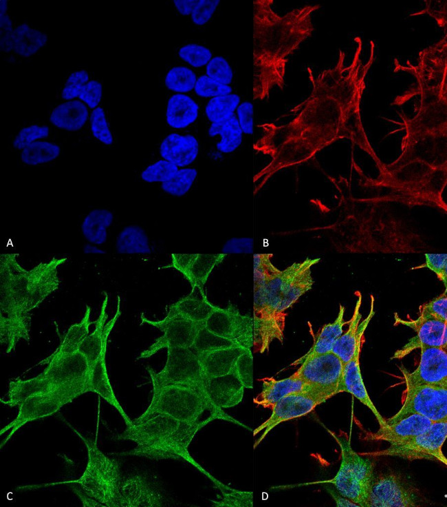 NMDAR2A Antibody in Immunocytochemistry (ICC/IF)