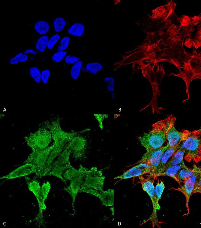 alpha-2c Adrenergic Receptor Antibody in Immunocytochemistry (ICC/IF)