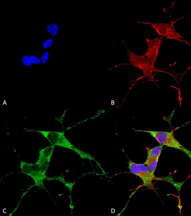 LRRK2 Antibody in Immunocytochemistry (ICC/IF)