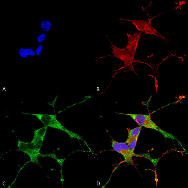 LRRK2 Antibody in Immunocytochemistry (ICC/IF)