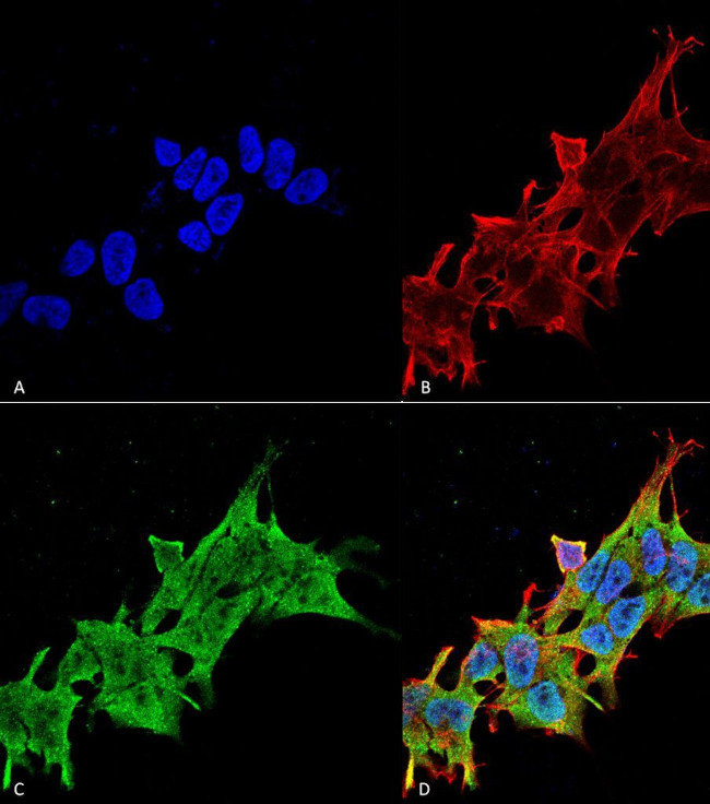 LRRK2 Antibody in Immunocytochemistry (ICC/IF)