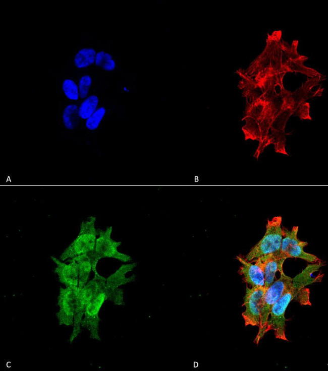 LRRK2 Antibody in Immunocytochemistry (ICC/IF)