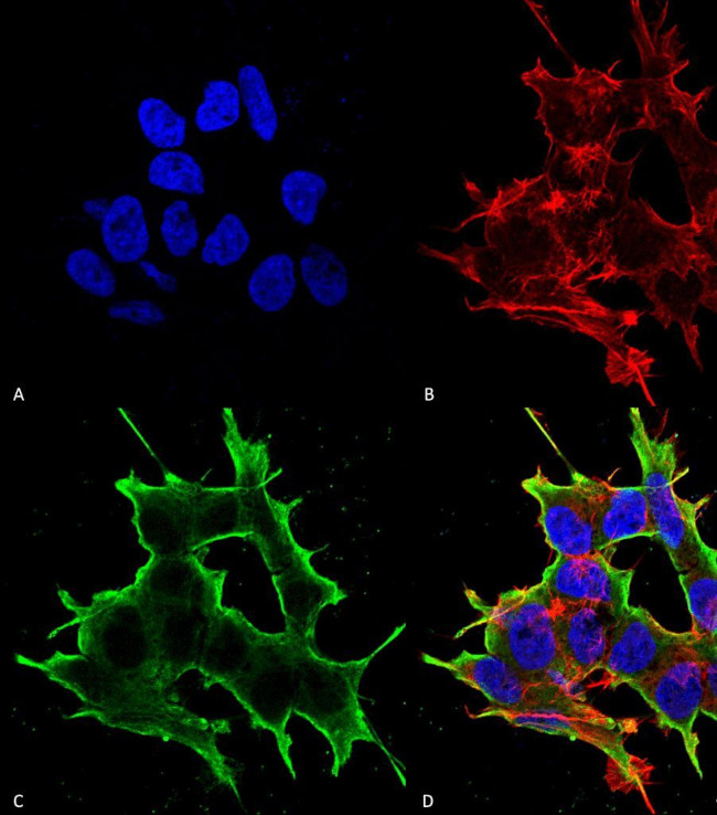 ATF4 Antibody in Immunocytochemistry (ICC/IF)