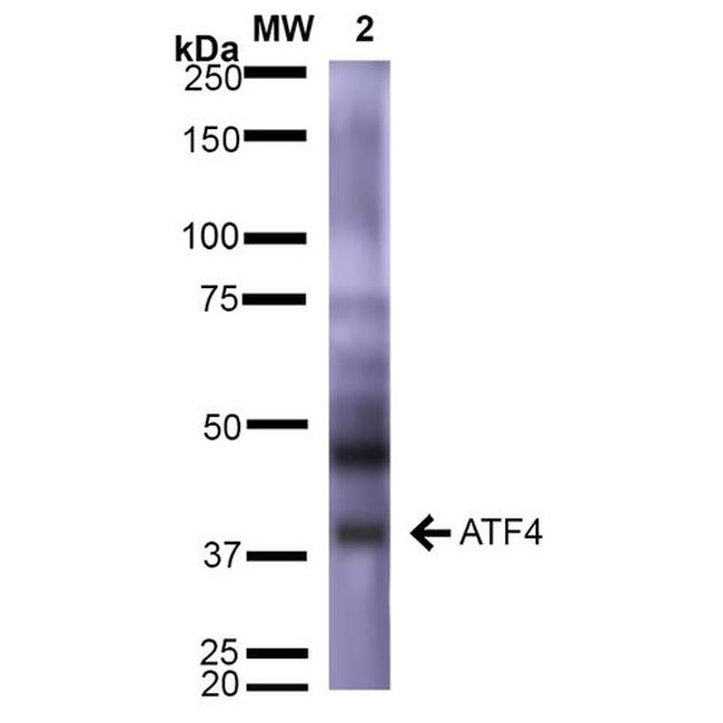 ATF4 Antibody in Western Blot (WB)