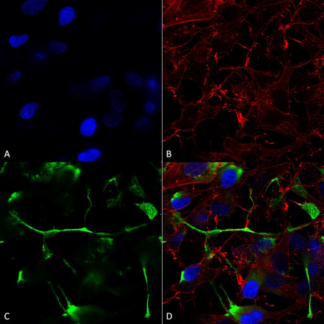 ATF4 Antibody in Immunocytochemistry (ICC/IF)