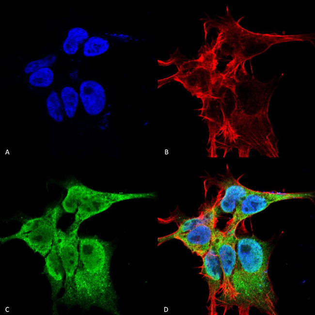 FGF13 Antibody in Immunocytochemistry (ICC/IF)