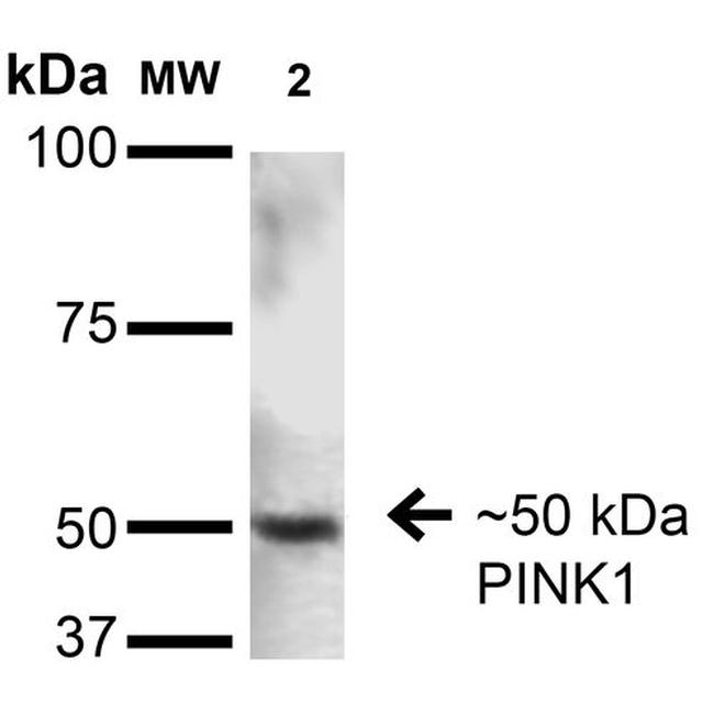 PINK1 Antibody in Western Blot (WB)