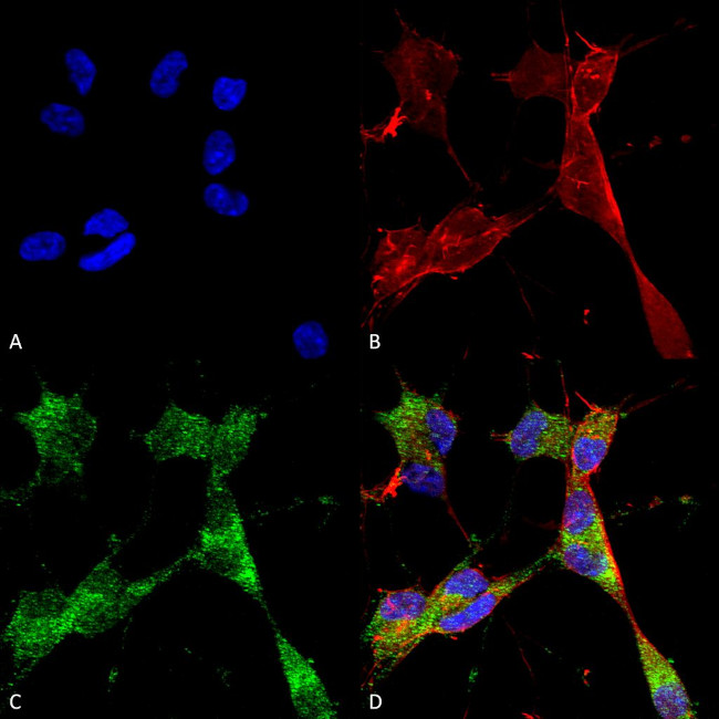 PINK1 Antibody in Immunocytochemistry (ICC/IF)