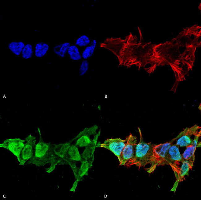 MFN2 Antibody in Immunocytochemistry (ICC/IF)