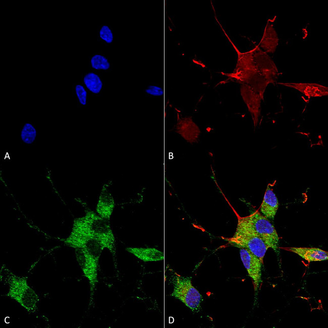 SHANK1/SHANK3 Antibody in Immunocytochemistry (ICC/IF)