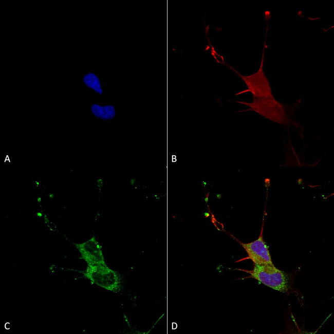 LGI1 Antibody in Immunocytochemistry (ICC/IF)