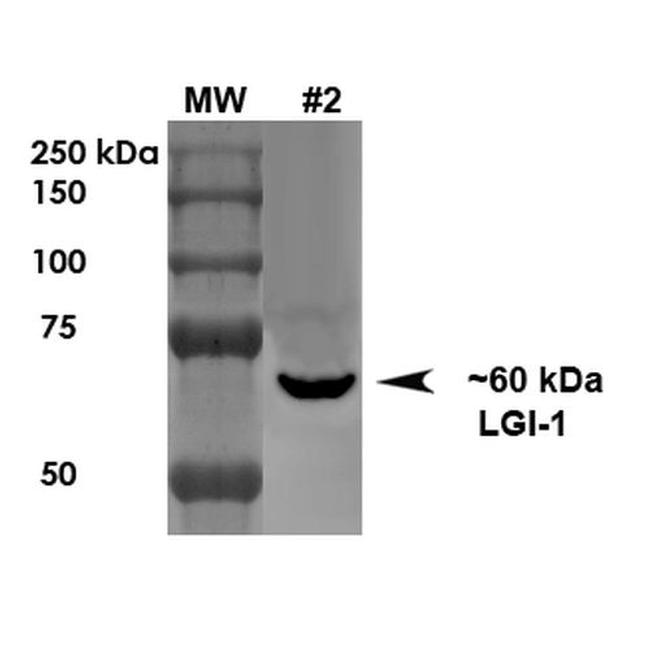 LGI1 Antibody in Western Blot (WB)