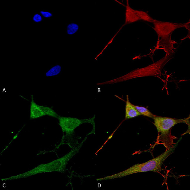 NRCAM Antibody in Immunocytochemistry (ICC/IF)