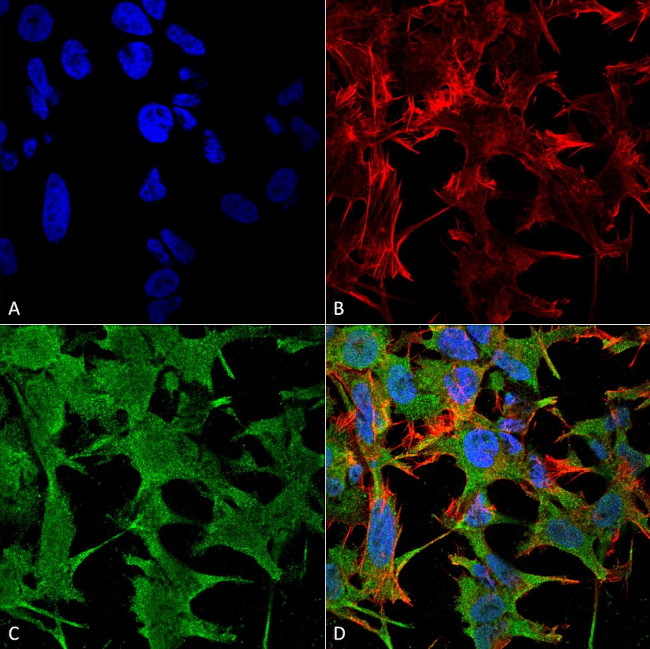 NRCAM Antibody in Immunocytochemistry (ICC/IF)