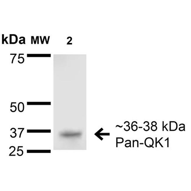 QKI Antibody in Western Blot (WB)