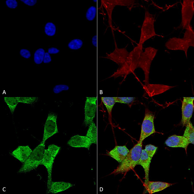 KCNK3 Antibody in Immunocytochemistry (ICC/IF)