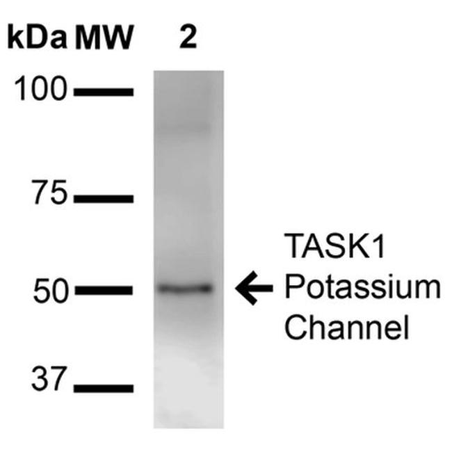 KCNK3 Antibody in Western Blot (WB)