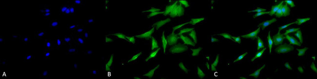 HSF1 Antibody in Immunocytochemistry (ICC/IF)