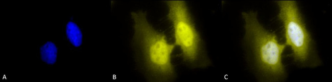 HSF1 Antibody in Immunocytochemistry (ICC/IF)