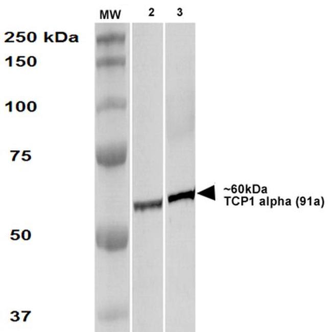 TCP1 Antibody in Western Blot (WB)