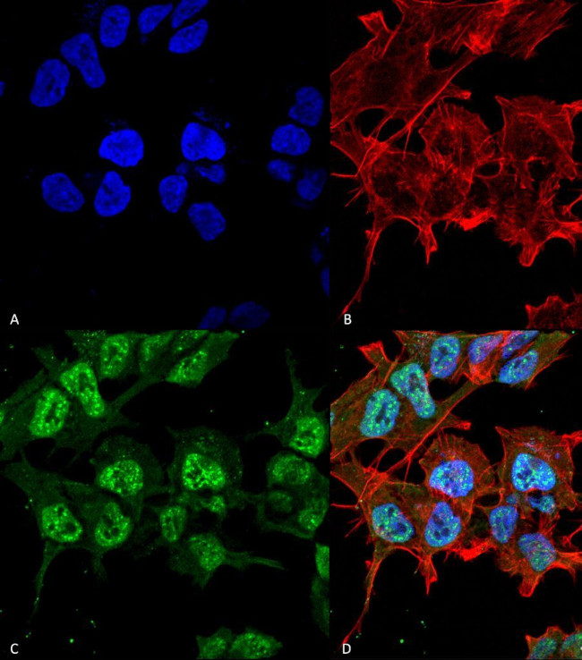 GABRA2 Antibody in Immunocytochemistry (ICC/IF)