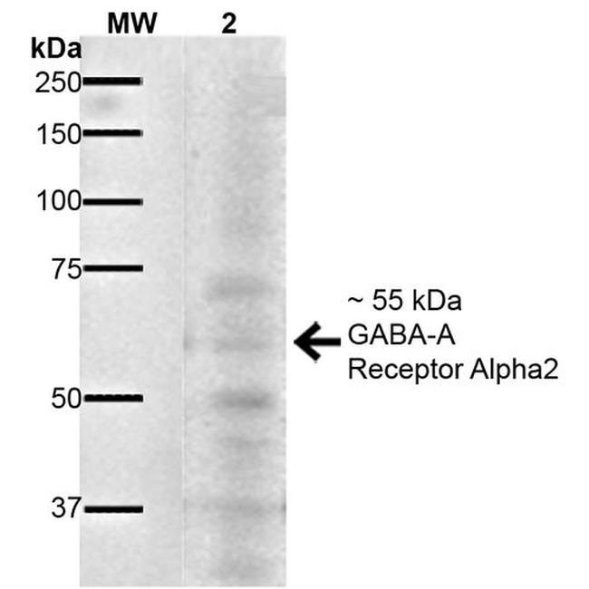 GABRA2 Antibody in Western Blot (WB)