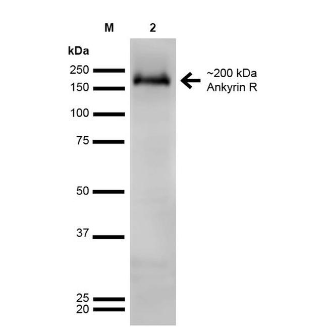 Ankyrin 1 Antibody in Western Blot (WB)