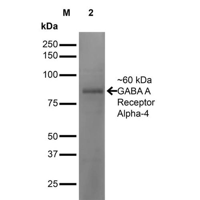 GABRA4 Antibody in Western Blot (WB)