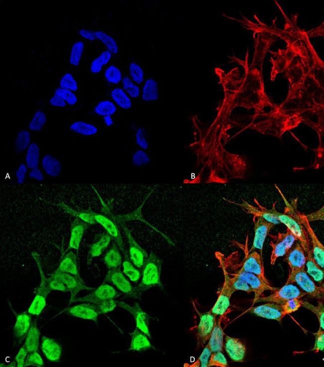 SCN3B Antibody in Immunocytochemistry (ICC/IF)