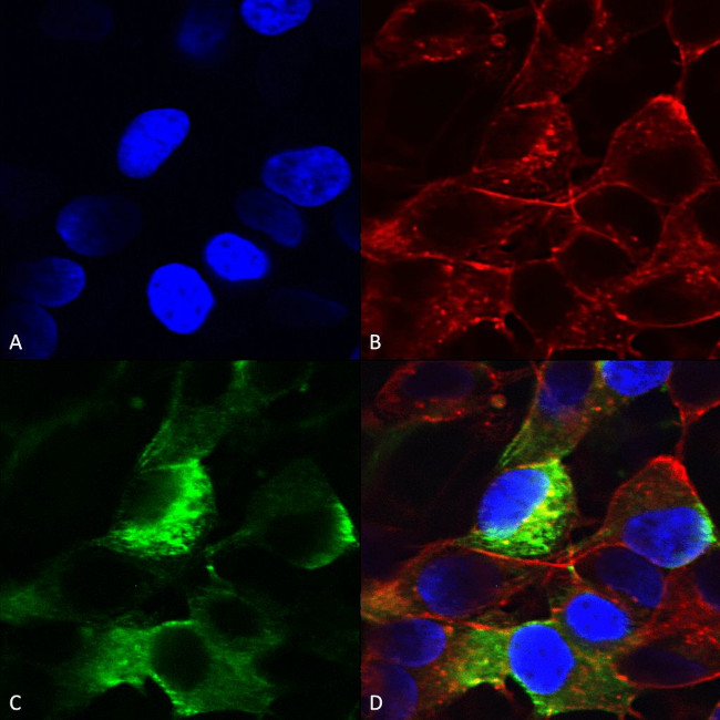 SCN3B Antibody in Immunocytochemistry (ICC/IF)