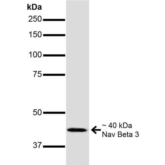 SCN3B Antibody in Western Blot (WB)